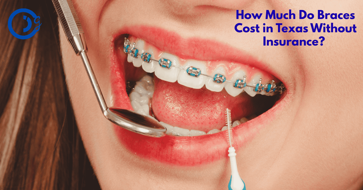 How Much Do Braces Cost in Texas Without Insurance? Real Prices & Tips