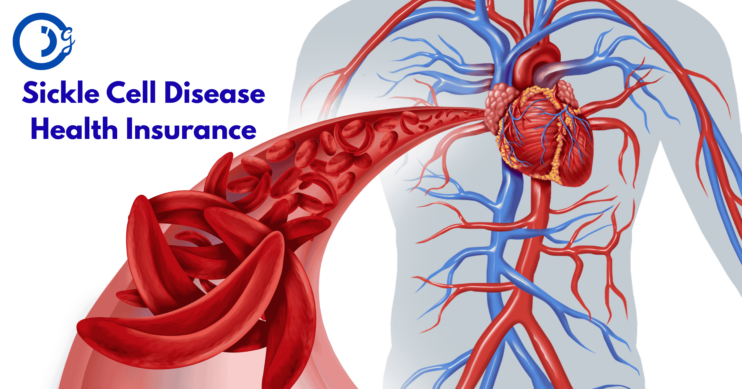 Sickle Cell Disease Health Insurance: Real Stories, Coverage & Hope